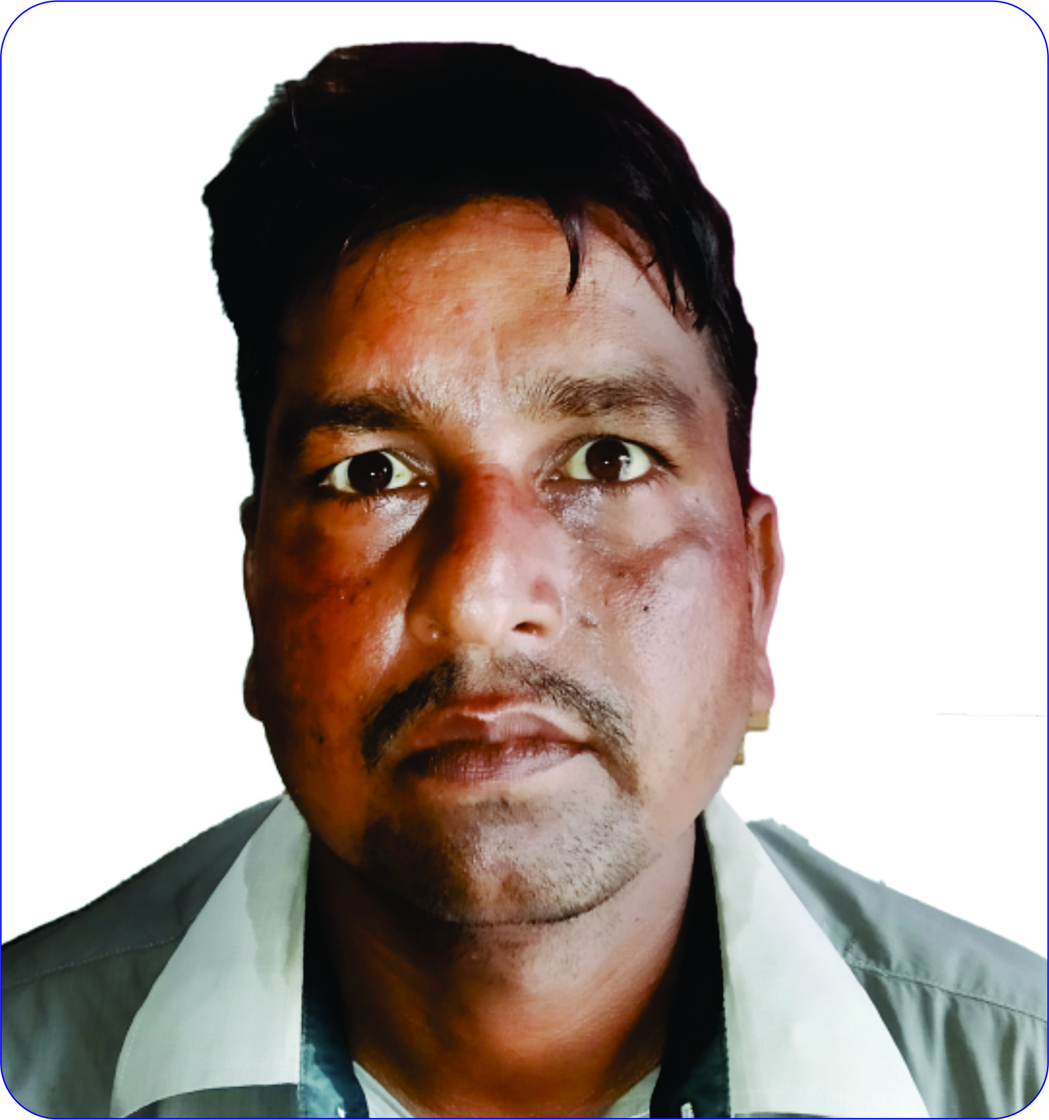 Sunil Kumar Yadav